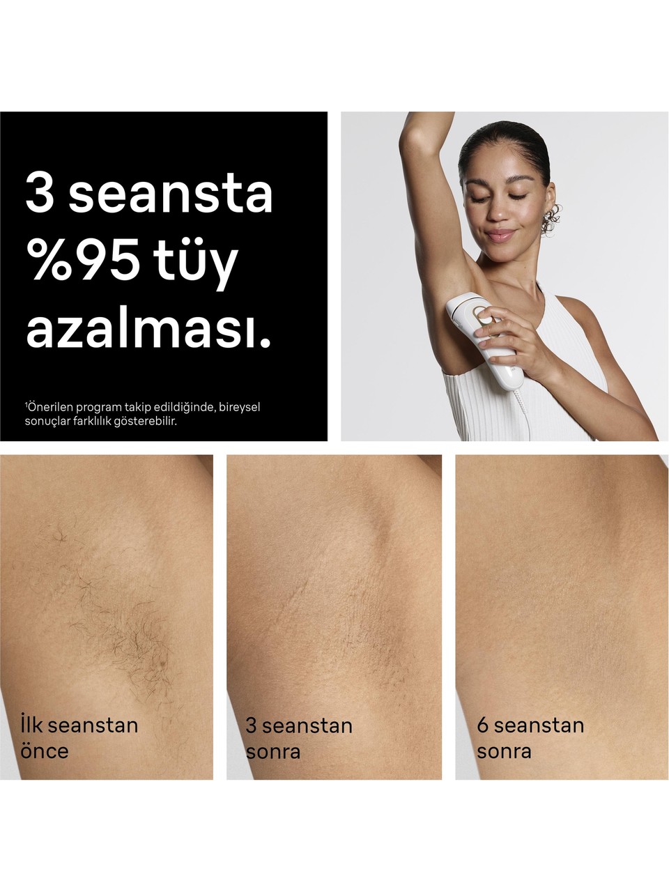 Braun Silk Expert Pro 5 Pl5311 Ipl Lazer Epilasyon Aleti Görseli