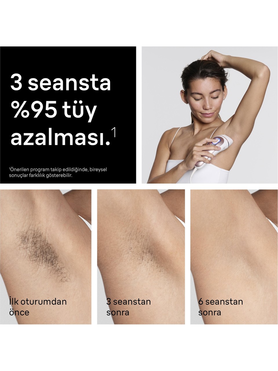 Braun Skin I-expert Pl7431 Ipl Lazer Epilasyon Aleti Görseli